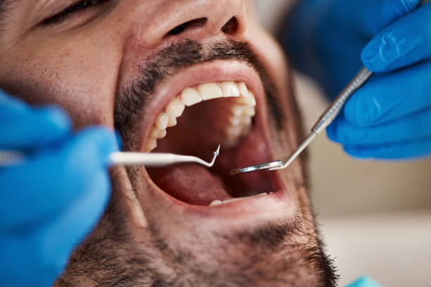 Best Urgent Tooth Repair  in North Adams, MA